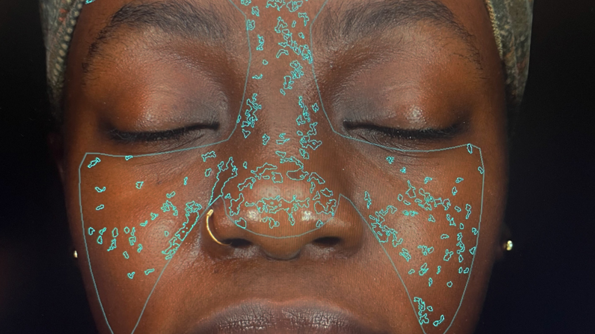 The image shows a person with their eyes closed, wearing a headgear with sensors attached to it, likely for a medical or scientific purpose, such as a brain scan or monitoring device.